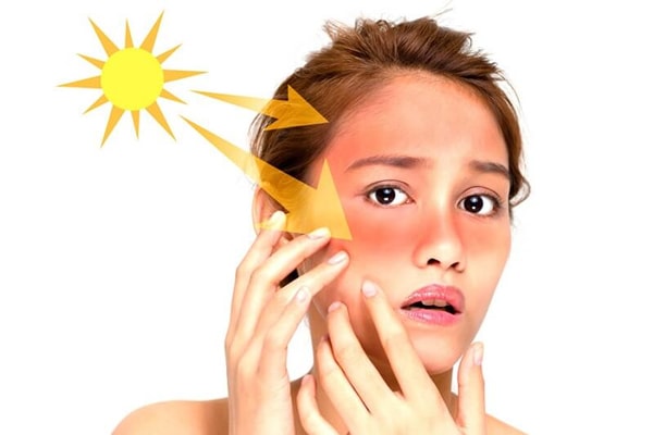 Tia cực tím từ ánh nắng mặt trời có thể làm giảm độ đàn hồi của da